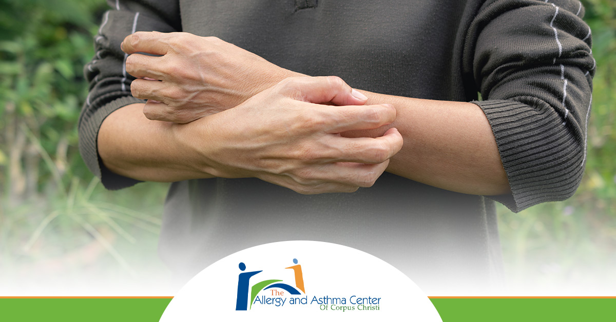 howtorecognizeallergy-blog-5c07e997cdc89