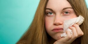 allergies